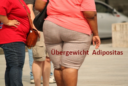 Beitrag "Übergewicht | Adipositas" | menssensus® Institut Forschungsinstitut & Therapiezentrum Zülpich